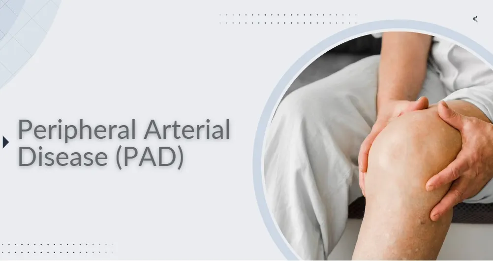 Trental 400mg and Peripheral Arterial Disease 